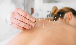 Acupuncture South Carolina