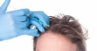 PRP Hair Restoration